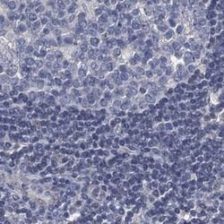 Invitrogen RTKN2 Polyclonal Antibody 100 &mu;L; Unconjugated:Antibodies,