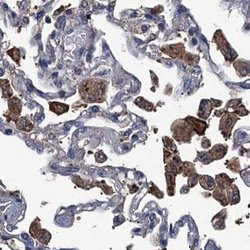 Invitrogen RTKN2 Polyclonal Antibody 100 &mu;L; Unconjugated:Antibodies,