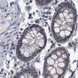 Invitrogen RTKN2 Polyclonal Antibody 100 &mu;L; Unconjugated:Antibodies,