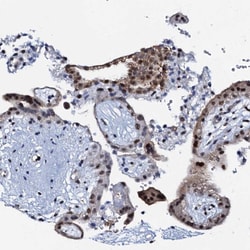 Invitrogen OLAH Polyclonal Antibody 100 &mu;L; Unconjugated:Antibodies,
