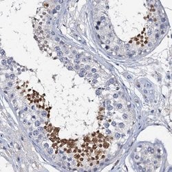 Invitrogen OLAH Polyclonal Antibody 100 &mu;L; Unconjugated:Antibodies,