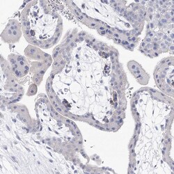 Invitrogen NRAP Polyclonal Antibody 100 &mu;L; Unconjugated:Antibodies,