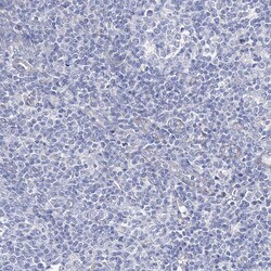 Invitrogen NRAP Polyclonal Antibody 100 &mu;L; Unconjugated:Antibodies,