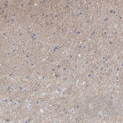 Invitrogen LPHN1 Polyclonal Antibody 100 &mu;L; Unconjugated:Antibodies,