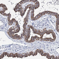 Invitrogen LPHN1 Polyclonal Antibody 100 &mu;L; Unconjugated:Antibodies,