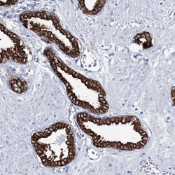 Invitrogen LPHN1 Polyclonal Antibody 100 &mu;L; Unconjugated:Antibodies,