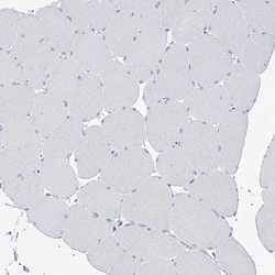Invitrogen LPHN1 Polyclonal Antibody 100 &mu;L; Unconjugated:Antibodies,