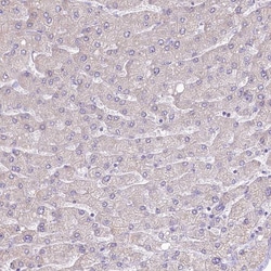 Invitrogen SLC6A11 Polyclonal Antibody 100 &mu;L; Unconjugated:Antibodies,