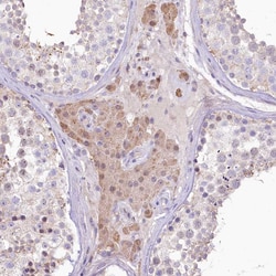 Invitrogen SLC6A11 Polyclonal Antibody 100 &mu;L; Unconjugated:Antibodies,