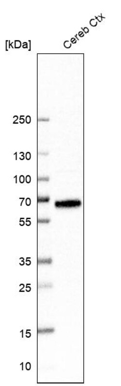 Invitrogen SLC6A11 Polyclonal Antibody 100 &mu;L; Unconjugated:Antibodies,