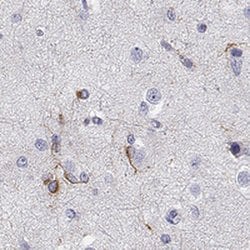 Invitrogen MAP6D1 Polyclonal Antibody 100 &mu;L; Unconjugated:Antibodies,