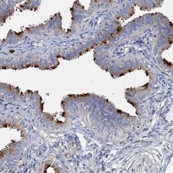 Invitrogen AGBL4 Polyclonal Antibody 100 &mu;L; Unconjugated:Antibodies,