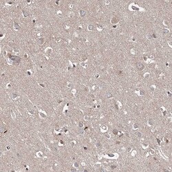 Invitrogen MEPE Polyclonal Antibody 100 &mu;L | Buy Online | Invitrogen&trade; | Fisher Scientific