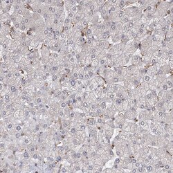 Invitrogen MEPE Polyclonal Antibody 100 &mu;L | Buy Online | Invitrogen&trade; | Fisher Scientific