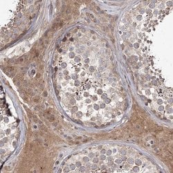 Invitrogen KIAA0825 Polyclonal Antibody 100 &mu;L; Unconjugated:Antibodies,