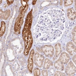 Invitrogen PTER Polyclonal Antibody 100 &mu;L; Unconjugated:Antibodies,