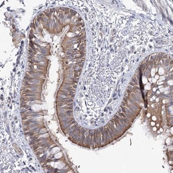 Invitrogen LRRC14B Polyclonal Antibody 100 &mu;L; Unconjugated:Antibodies,