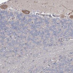 Invitrogen 3BP5L Polyclonal Antibody 100 &mu;L; Unconjugated:Antibodies,
