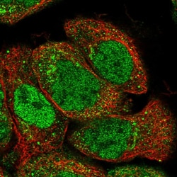 Invitrogen 3BP5L Polyclonal Antibody 100 &mu;L; Unconjugated:Antibodies,
