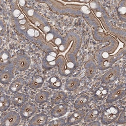 Invitrogen 3BP5L Polyclonal Antibody 100 &mu;L; Unconjugated:Antibodies,