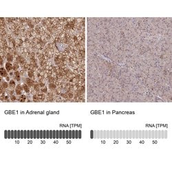 Invitrogen GBE1 Polyclonal Antibody 100 &mu;L | Buy Online | Invitrogen&trade; | Fisher Scientific