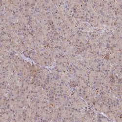 Invitrogen GBE1 Polyclonal Antibody 100 &mu;L | Buy Online | Invitrogen&trade; | Fisher Scientific