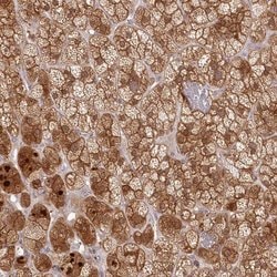 Invitrogen GBE1 Polyclonal Antibody 100 &mu;L | Buy Online | Invitrogen&trade; | Fisher Scientific