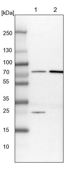 Invitrogen GBE1 Polyclonal Antibody 100 &mu;L | Buy Online | Invitrogen&trade; | Fisher Scientific