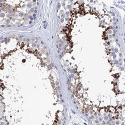 Invitrogen SPATA7 Polyclonal Antibody 100 &mu;L; Unconjugated:Antibodies,