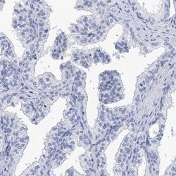 Invitrogen SPATA7 Polyclonal Antibody 100 &mu;L; Unconjugated:Antibodies,