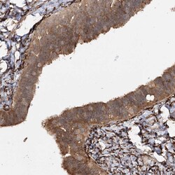Invitrogen WDR44 Polyclonal Antibody 100 &mu;L; Unconjugated:Antibodies,