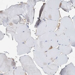 Invitrogen WDR44 Polyclonal Antibody 100 &mu;L; Unconjugated:Antibodies,