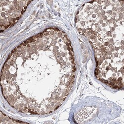 Invitrogen WDR44 Polyclonal Antibody 100 &mu;L; Unconjugated:Antibodies,