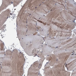Invitrogen MTRR Polyclonal Antibody 100 &mu;L | Buy Online | Invitrogen&trade; | Fisher Scientific
