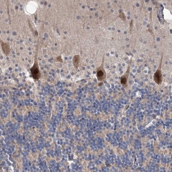 Invitrogen PPP2R2B Polyclonal Antibody 100 &mu;L; Unconjugated:Antibodies,
