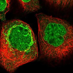 Invitrogen CREB3L4 Polyclonal Antibody 100 &mu;L; Unconjugated:Antibodies,
