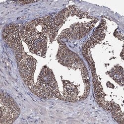 Invitrogen CREB3L4 Polyclonal Antibody 100 &mu;L; Unconjugated:Antibodies,