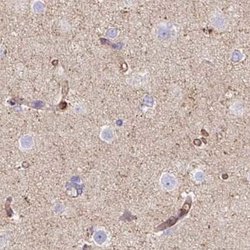 Invitrogen HIP1R Polyclonal Antibody 100 &mu;L | Buy Online | Invitrogen&trade; | Fisher Scientific