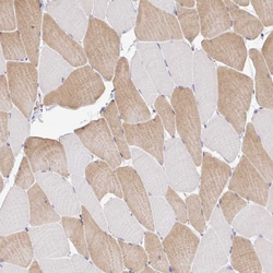 Invitrogen PLCD4 Polyclonal Antibody 100 &mu;L | Buy Online | Invitrogen&trade; | Fisher Scientific