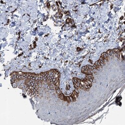 Invitrogen IQSEC1 Polyclonal Antibody 100 &mu;L; Unconjugated:Antibodies,