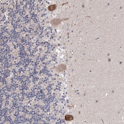 Invitrogen Connexin 31.1 Polyclonal Antibody 100 &mu;L; Unconjugated:Antibodies,
