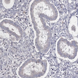 Invitrogen Connexin 31.1 Polyclonal Antibody 100 &mu;L; Unconjugated:Antibodies,