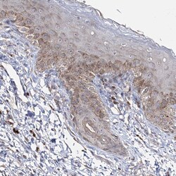 Invitrogen Connexin 31.1 Polyclonal Antibody 100 &mu;L; Unconjugated:Antibodies,