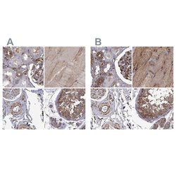 Invitrogen MAP4 Polyclonal Antibody 100 &mu;L | Buy Online | Invitrogen&trade; | Fisher Scientific
