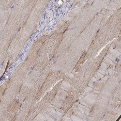 Invitrogen MAP4 Polyclonal Antibody 100 &mu;L | Buy Online | Invitrogen&trade; | Fisher Scientific