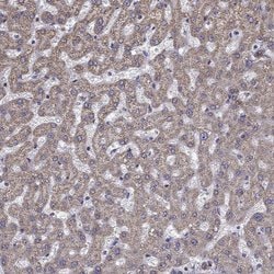 Invitrogen MAP4 Polyclonal Antibody 100 &mu;L | Buy Online | Invitrogen&trade; | Fisher Scientific