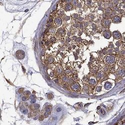 Invitrogen MAP4 Polyclonal Antibody 100 &mu;L | Buy Online | Invitrogen&trade; | Fisher Scientific