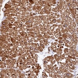 Invitrogen MAP4 Polyclonal Antibody 100 &mu;L | Buy Online | Invitrogen&trade; | Fisher Scientific