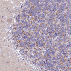 Invitrogen VPS26B Polyclonal Antibody 100 &mu;L; Unconjugated:Antibodies,