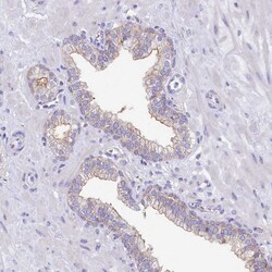 Invitrogen VPS26B Polyclonal Antibody 100 &mu;L; Unconjugated:Antibodies,